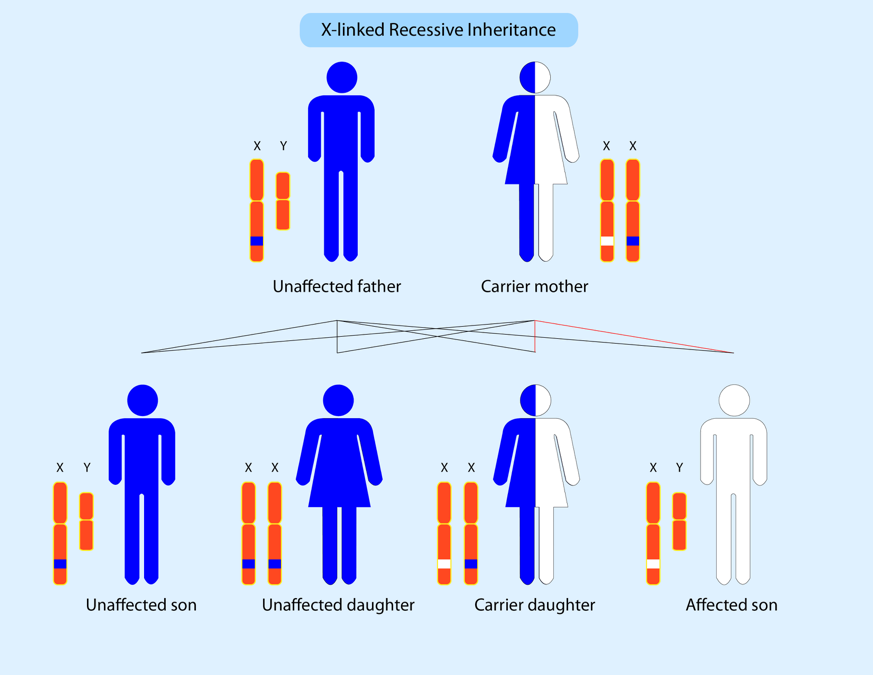 Duchenne Muscular Dystrophy Diagram